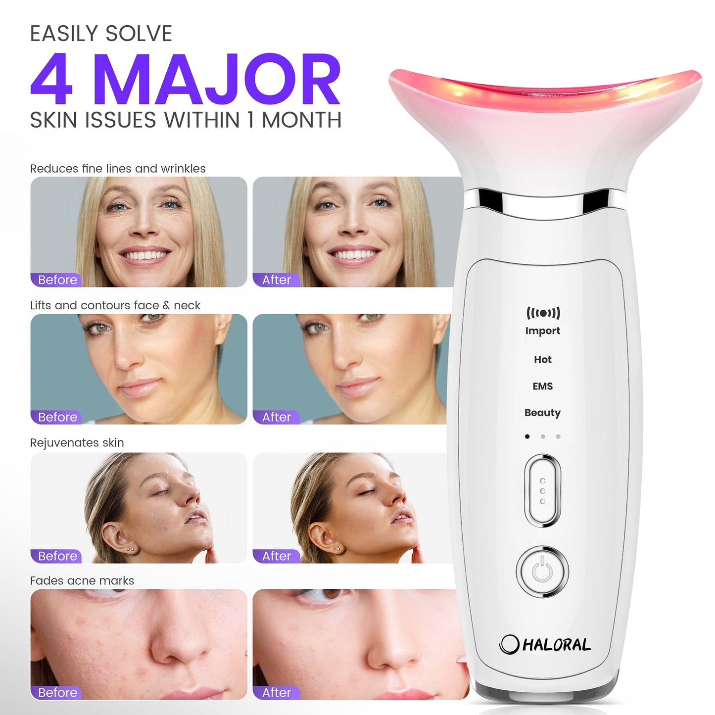 LiftPro Contour - 4 resultados reales antes y despues